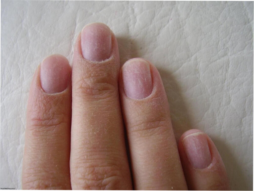 10 подсказок, которые помогут восстановить ногти после шеллака
